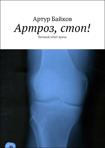 Артроз, стоп! Личный опыт врача - Байков (2018)_0.jpg